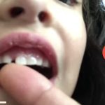 Dental Treatment