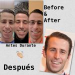 Before and after