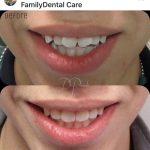 Before and after images